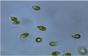 MIcroalga Dunaliella Salina