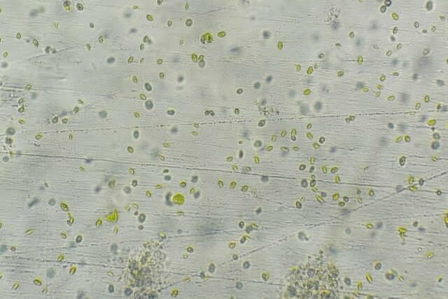 Microalga Chlorella cultivo14