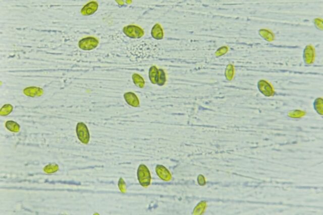 Microalga Chlorella cultivo15 chlorella